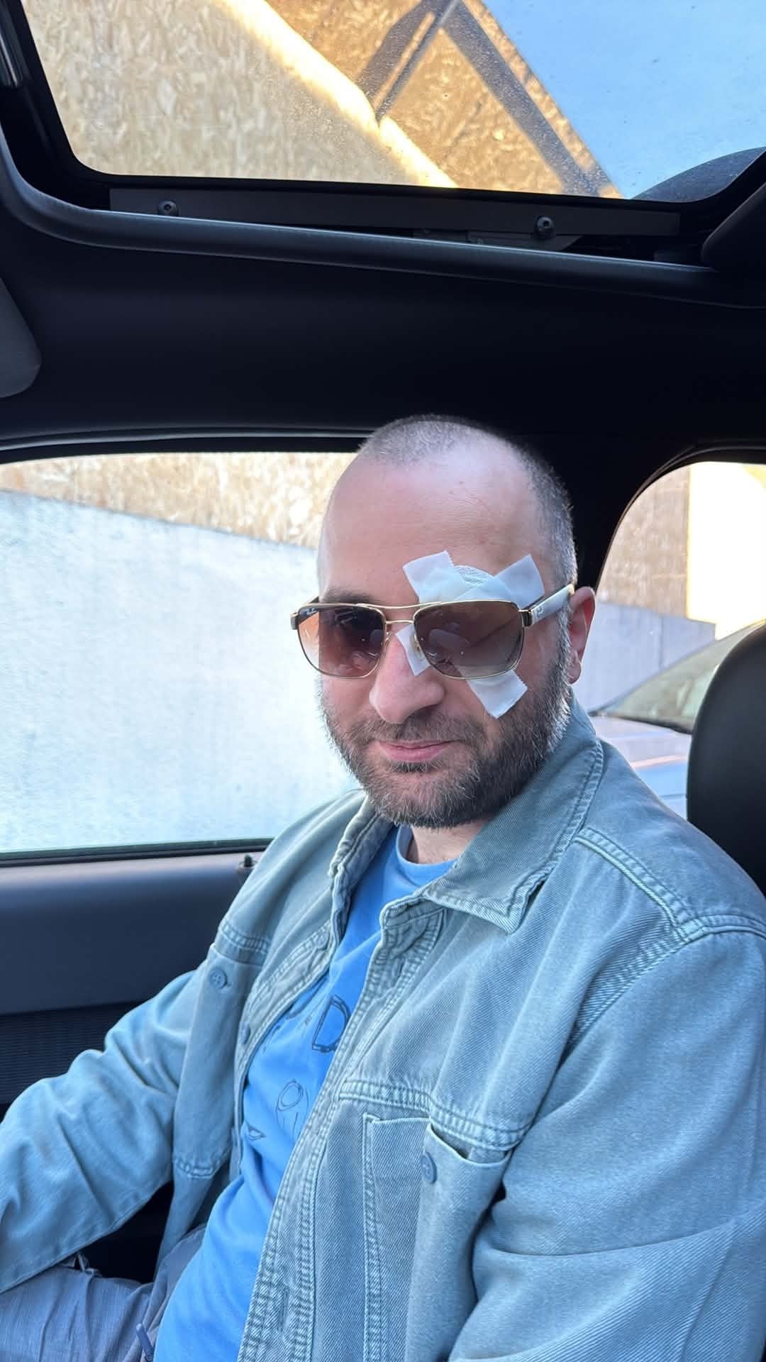 Me with a patched-up eye, pirate style